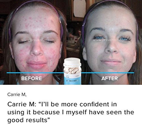OneCare Praventac & Ag-Factor Acne & Scar Support - 2 Bottles - image 4