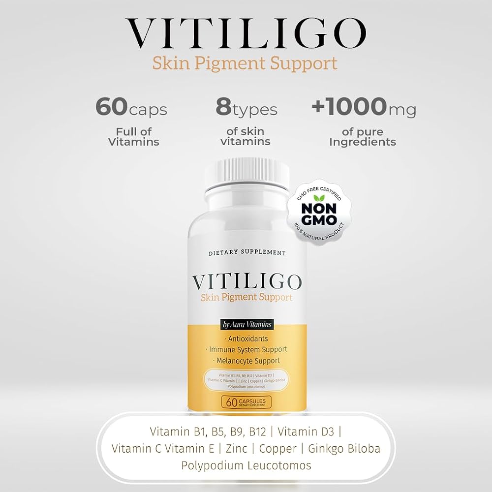 AURA VITAMINS Dermawonder Vitiligo Capsules 60 Count