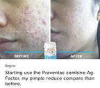 OneCare Praventac & Ag-Factor Acne & Scar Support - 2 Bottles - image 3