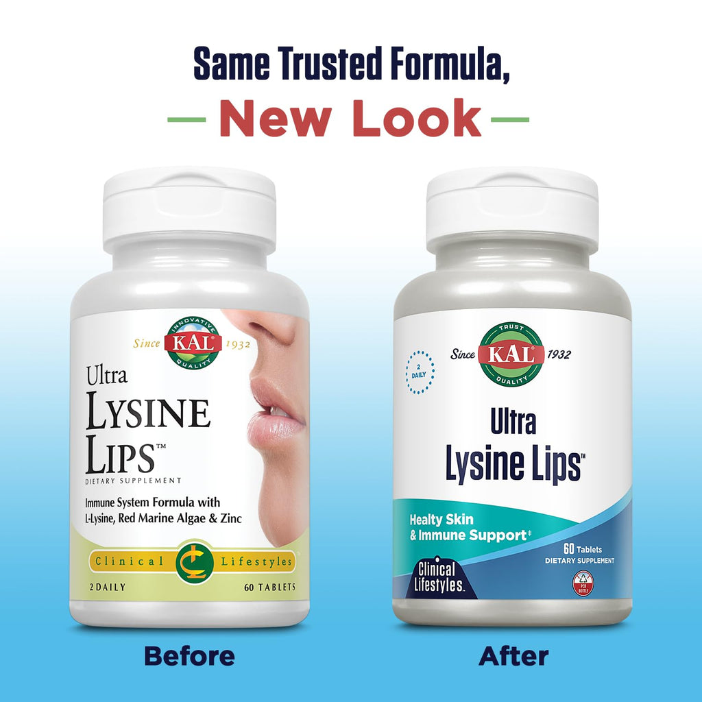 KAL Ultra Lysine Lips Supplement Tablets - 60 Count - image 2