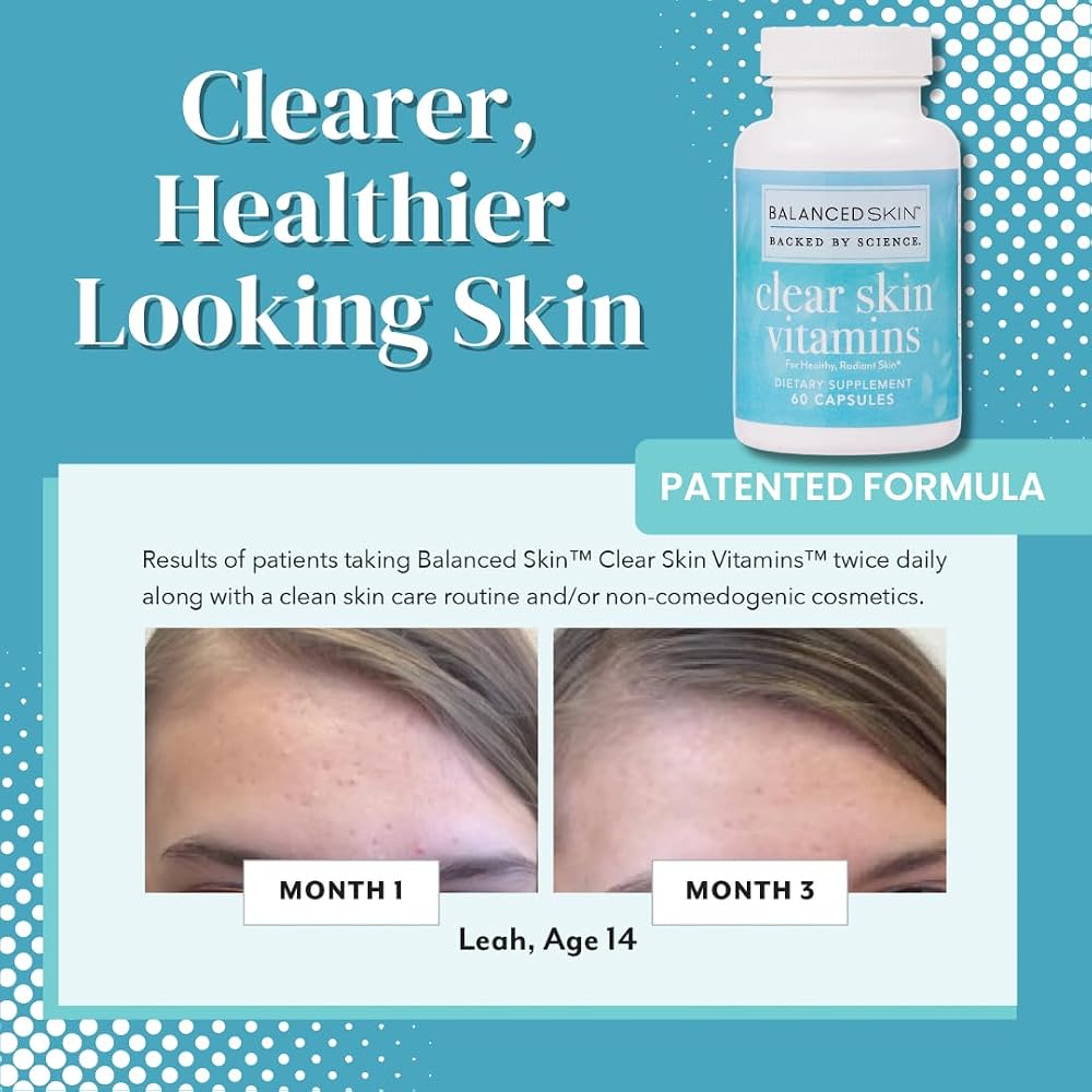 Balanced Skin Clear Skin Vitamins for Acne Control - 30 Capsules - image 2