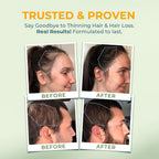 Vital NUTRITIVE Vital Hair Complex -Hair Growth Vitamins for Women