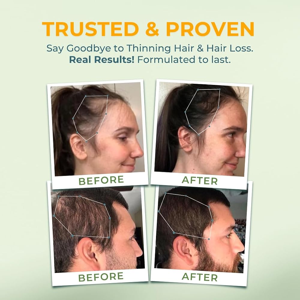Vital NUTRITIVE Vital Hair Complex -Hair Growth Vitamins for Women