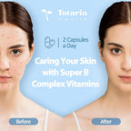 Totaria 13-in-1 Vitamin B Complex Plus with Vitamin B1