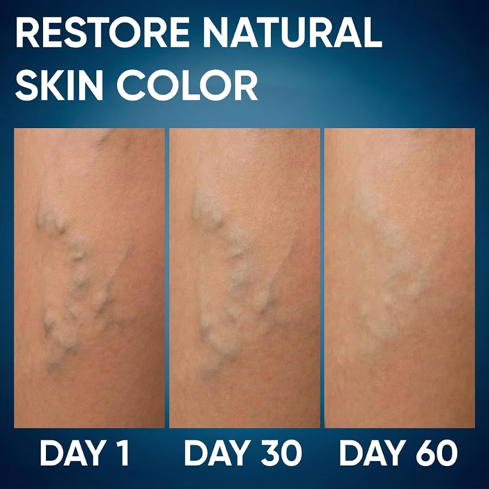 PENIKOSETE Leg Duo Botanical Cream & Herbal Tablets - 60 Tablets + 50ml - image 4