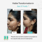 Beautywise Skin Resilience Capsules with Ceramides & Hyaluronic Acid - image 5