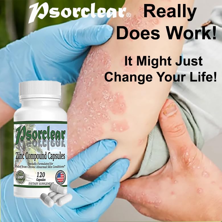 Psorclear Psoriasis & Eczema Relief - 120 Capsules - image 6