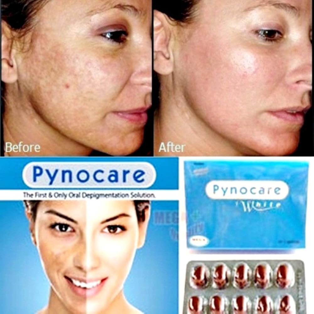 Mega Brands Pynocare White Treatment Melasma Capsules - 20 Softgels - image 4