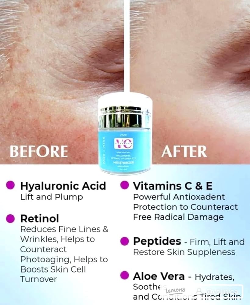 VCLINICA Hyaluronic Acid Moisturizer with Retinol & Vitamins - 4 Fl Oz - image 3