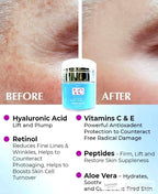 VCLINICA Hyaluronic Acid Moisturizer with Retinol & Vitamins - 4 Fl Oz - image 3