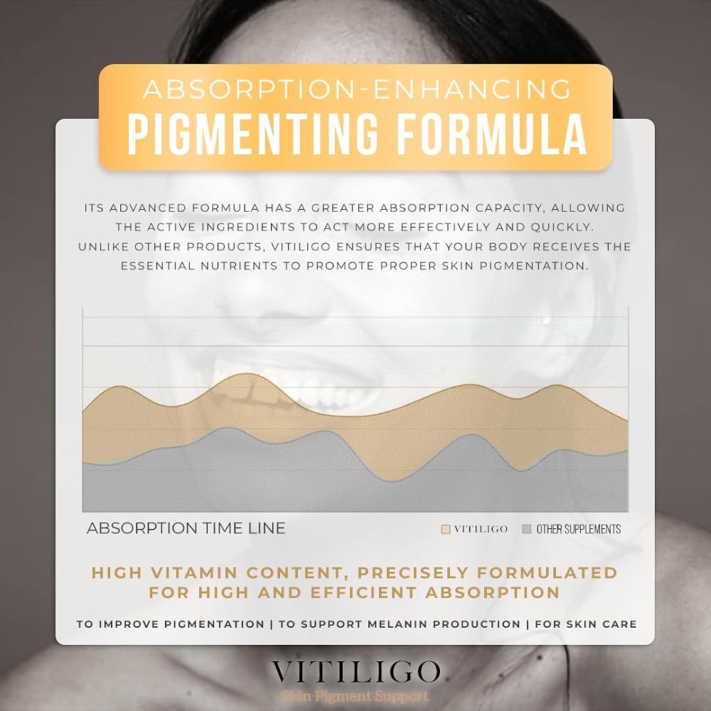 AURA VITAMINS Dermawonder Vitiligo Capsules 60 Count