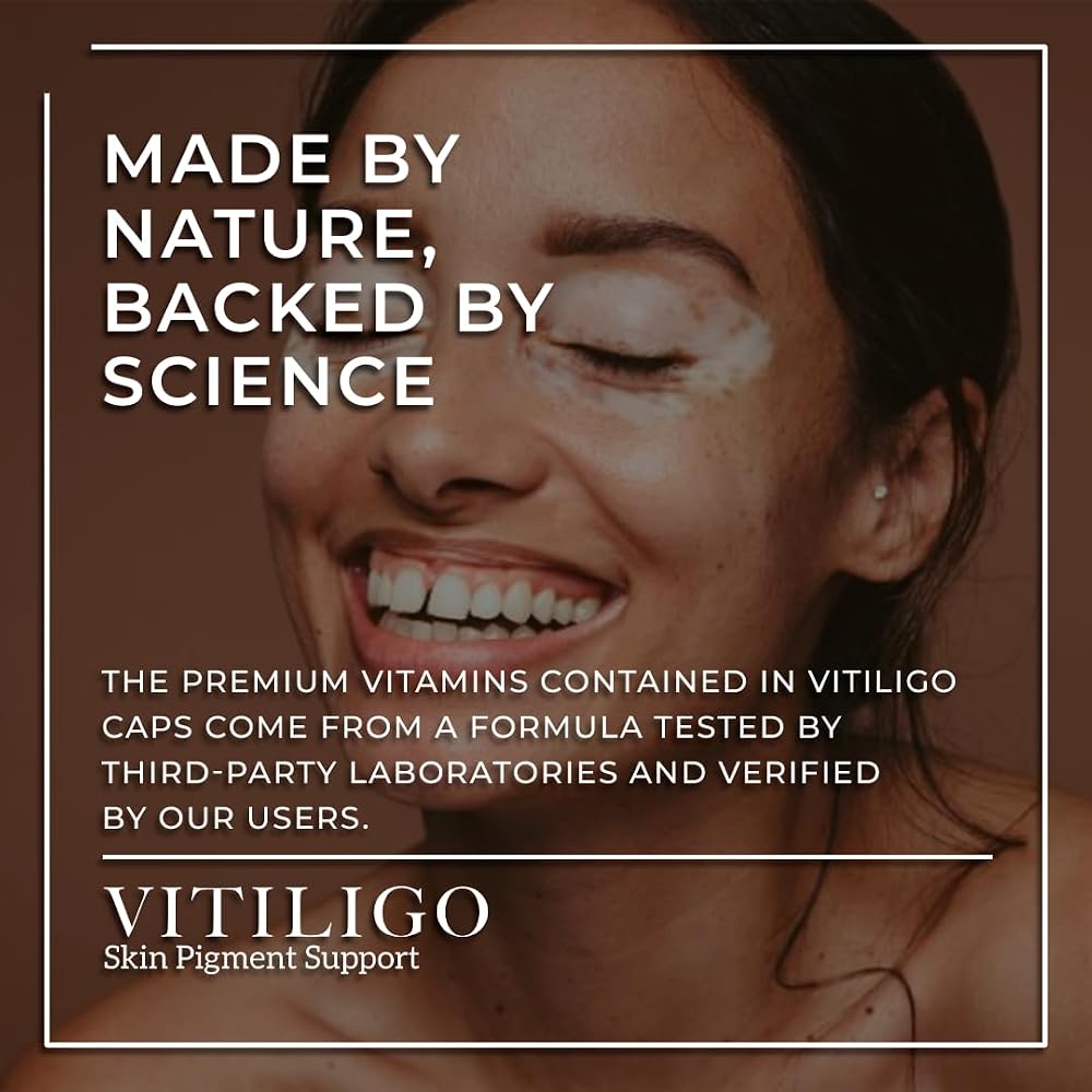 AURA VITAMINS Dermawonder Vitiligo Capsules 60 Count