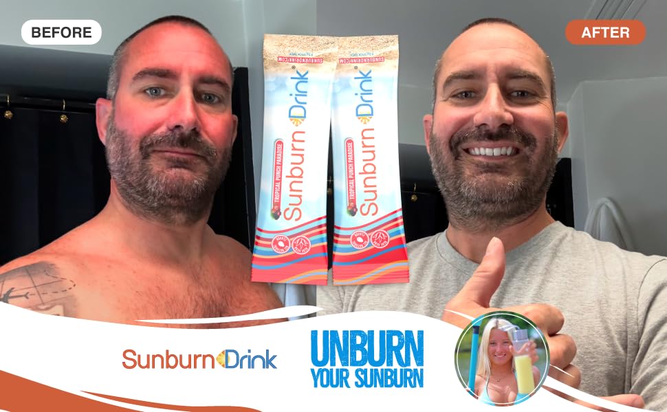 Sunburn Drink Tropical Punch Paradise Powder - 20 Packets - image 5