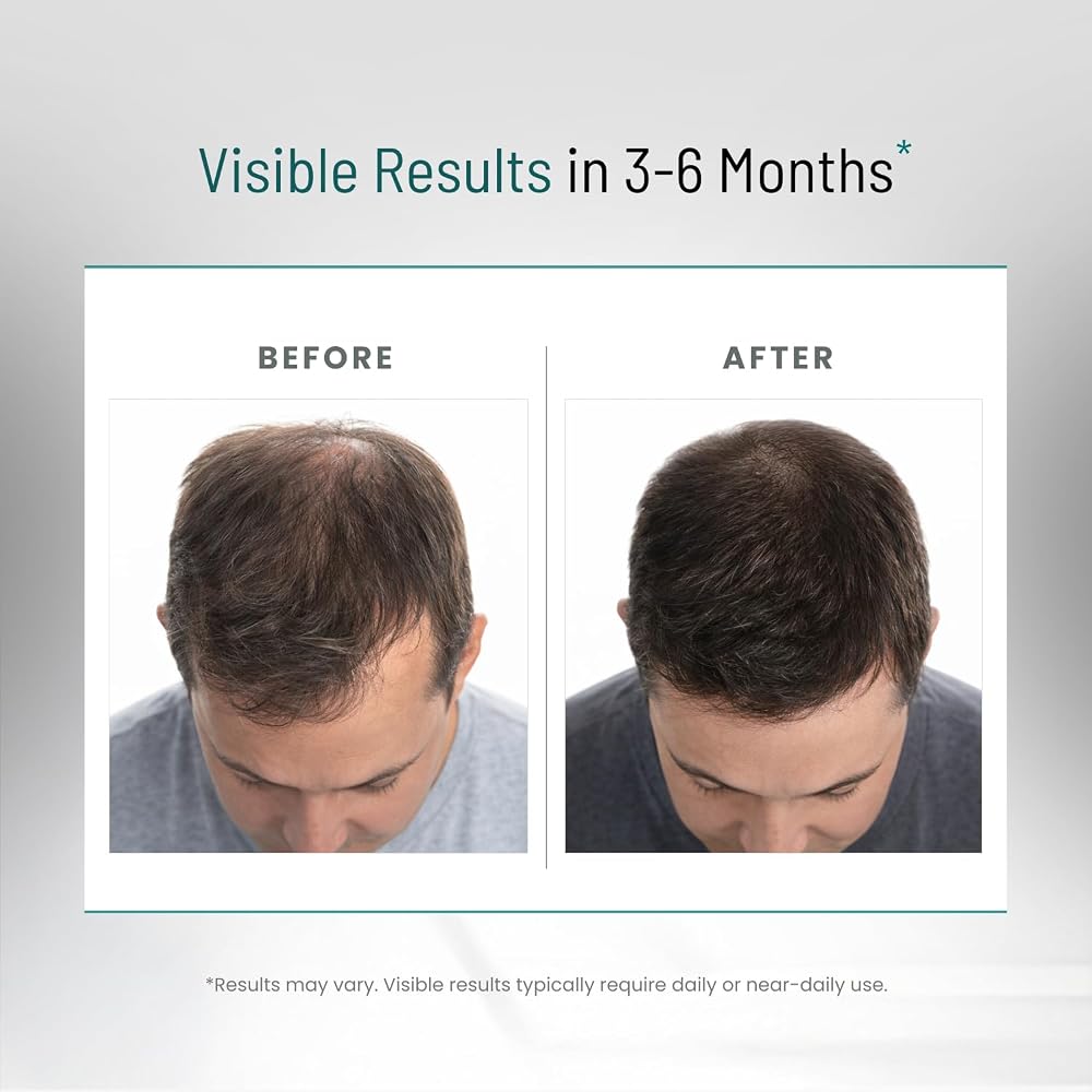 PEAK VITALS DHT Blocker Hair Growth Formula - 90 Capsules - image 7