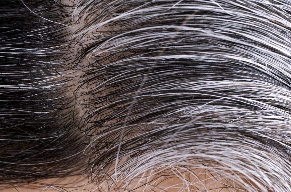 VIP Vitamins Gray Hair Reverse Complex - 60 Capsules - image 5