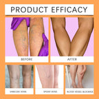 QCHIAN Turmeric Varicose Vein Patch - image 4