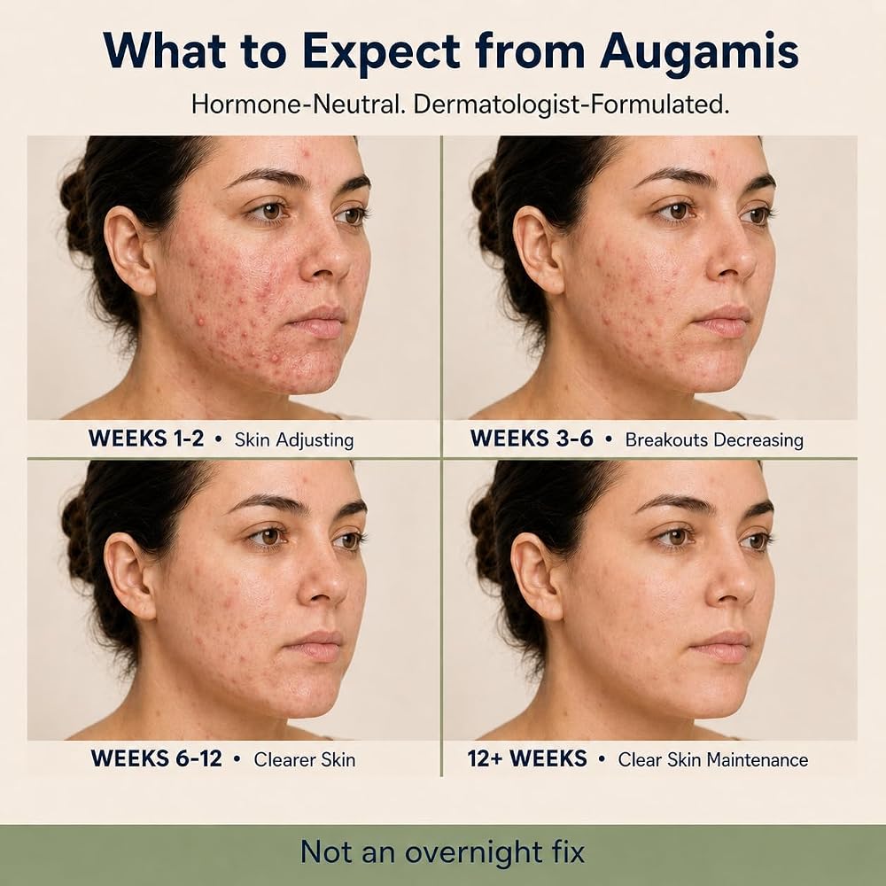Augamis Hormonal Acne Treatment for Women - No DIM - (60 Capsules