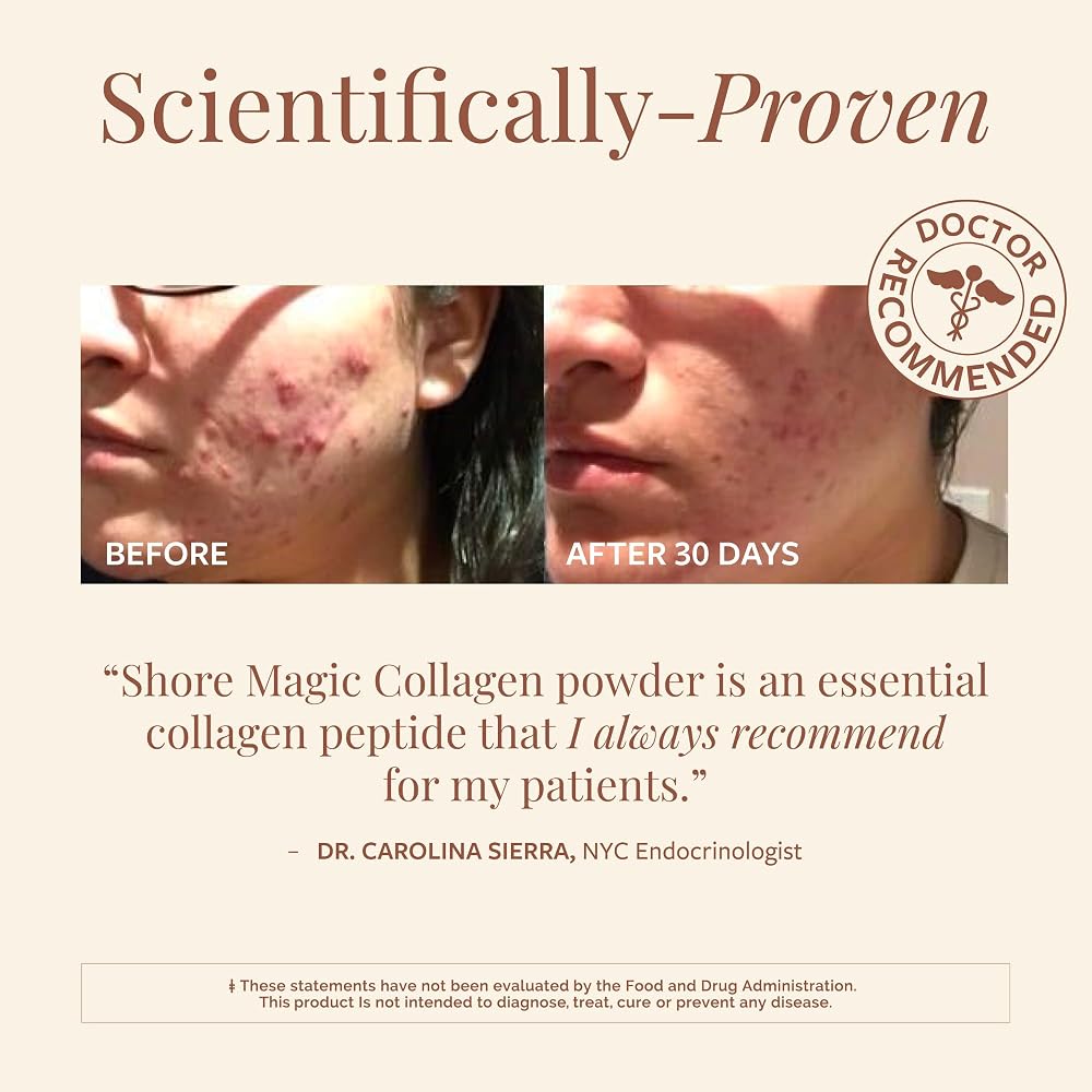 Shore Magic Premium Marine Collagen Powder Types I-IV - 30 Servings - image 4