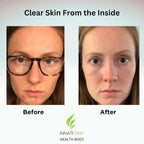Innate Skin Clear Skin Vitamin System - image 4