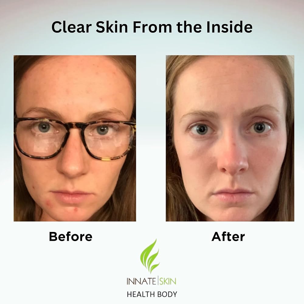 Innate Skin Clear Skin Vitamin System - image 4