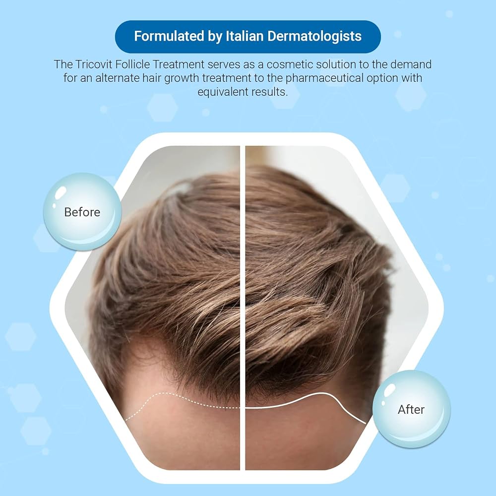 Tricovit Hair Growth Supplement - 60 Tablets - image 2