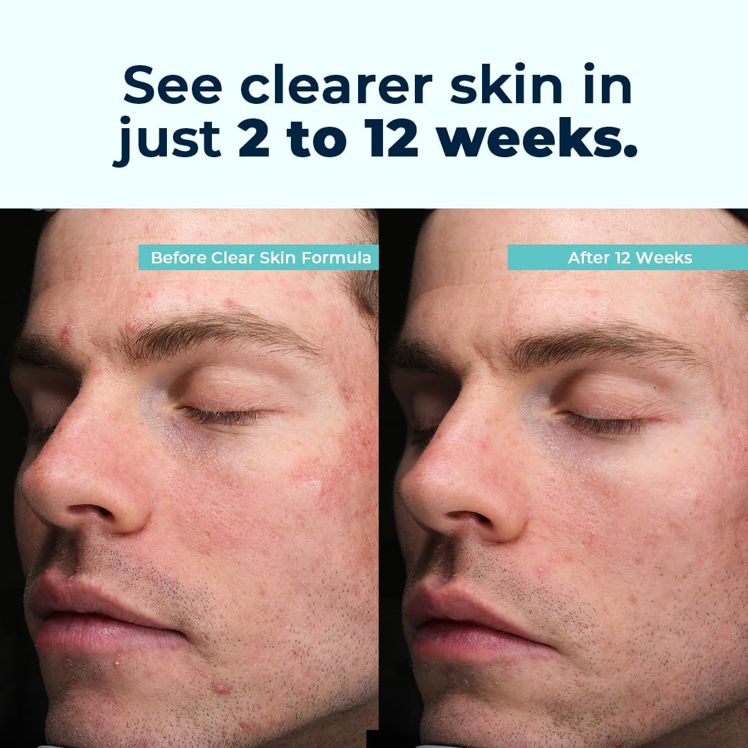 VitaMedica Clear Skin Vitamin Formula - 60 Capsules - image 4