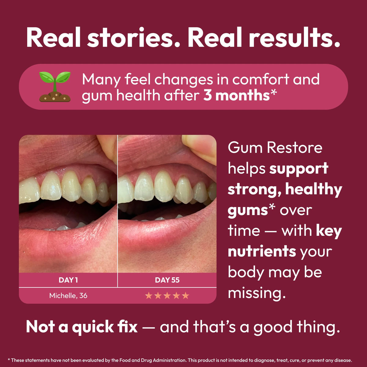 Strong Jaw Gum Restore Gum Health Supplement - 180 Capsules - image 5