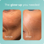 Biosil Collagen Generator - Original Capsules - with Patented ch-OSA