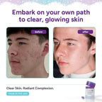 Clear AF Clear Skin Supplement with Ceramides & Zinc - 30 Capsules - image 3