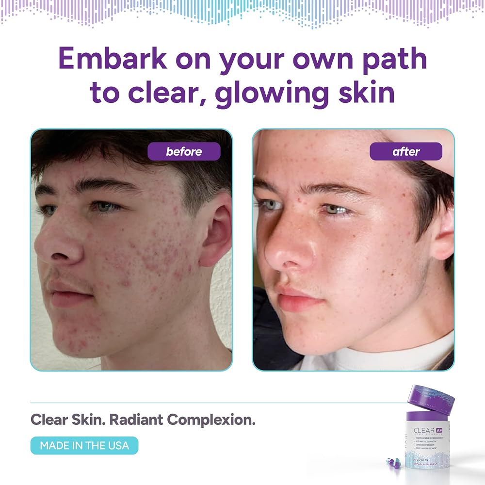 Clear AF Clear Skin Supplement with Ceramides & Zinc - 30 Capsules - image 3