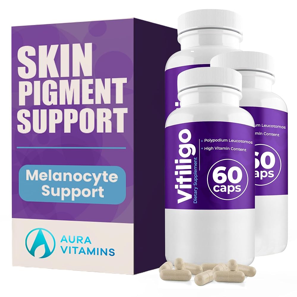 AURA VITAMINS - Vitiligo Capsules 60 Count