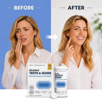 OraTicx Teeth & Gums Oral Probiotics Lozenge - 60 Lozenges - image 3