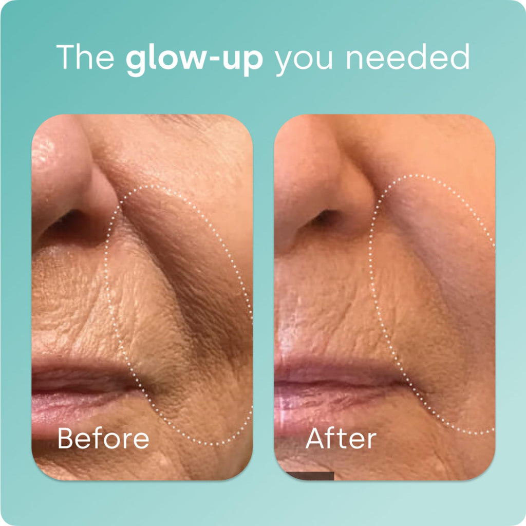 Biosil Collagen Booster Supplement - Drops - Patented ch-OSA