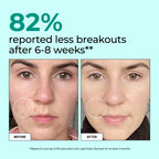 HUM Daily Cleanse Skin Health Supplement - 60 Capsules - image 3