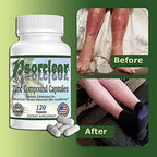 Psorclear Psoriasis & Eczema Relief - 120 Capsules - image 8