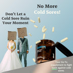 Ideal Wellness Cold Sore Treatment For Lips With Immune Support