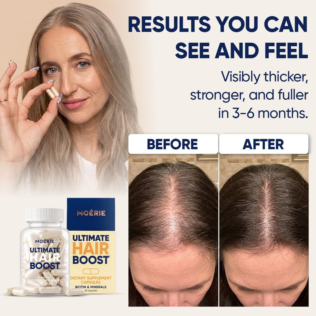 Moerie Ultimate Hair Boost Vitamins with Biotin - 180 Capsules - image 5