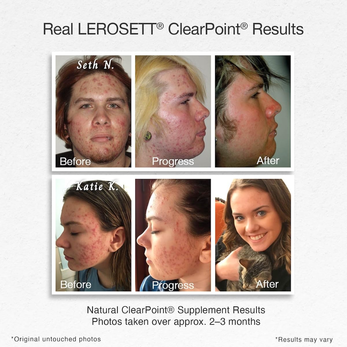 Gunilla Of Sweden ClearPoint Clear Skin Acne Supplement - 60 Capsules - image 2