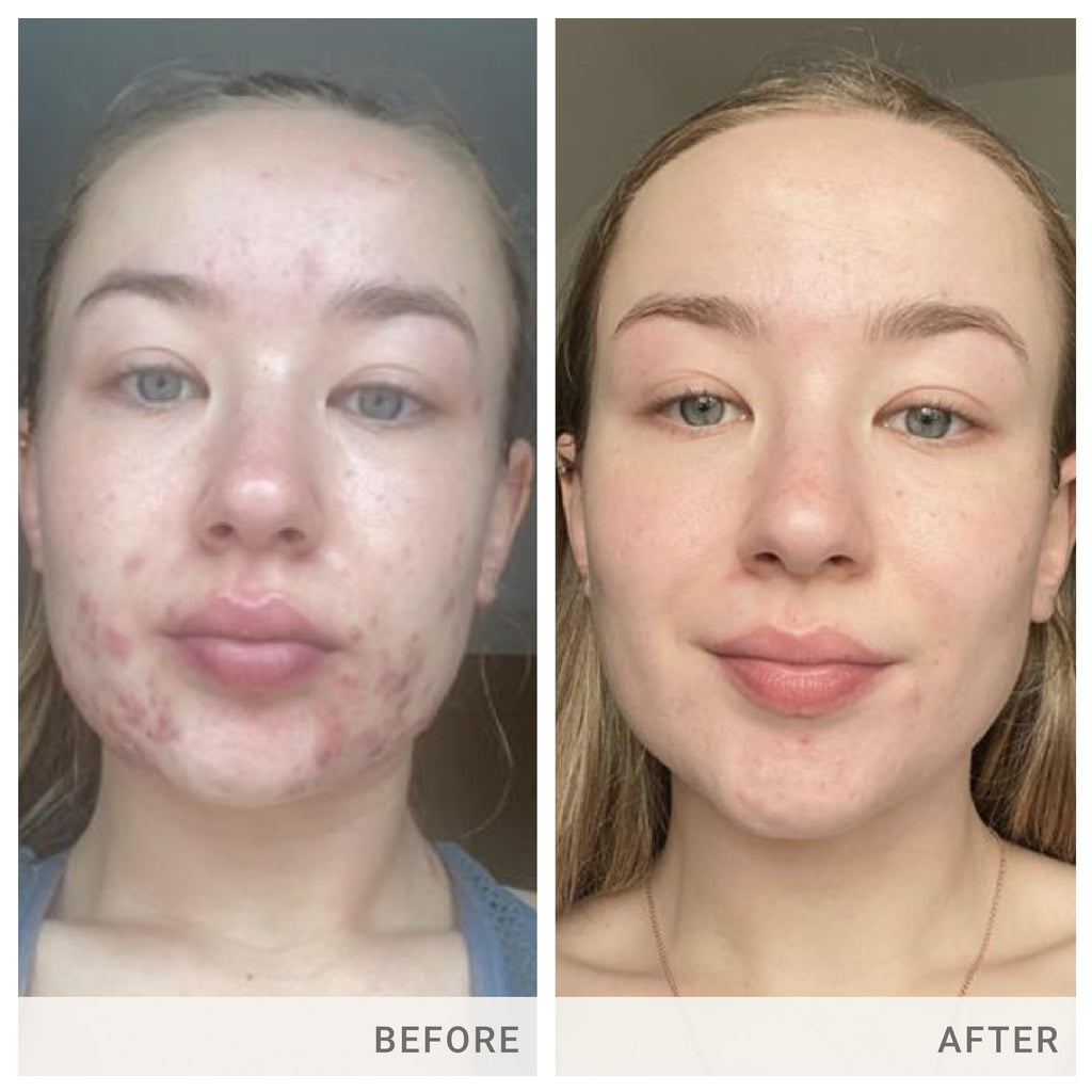 jane iredale Skin Accumax Supplement - 30-Day Supply - image 4