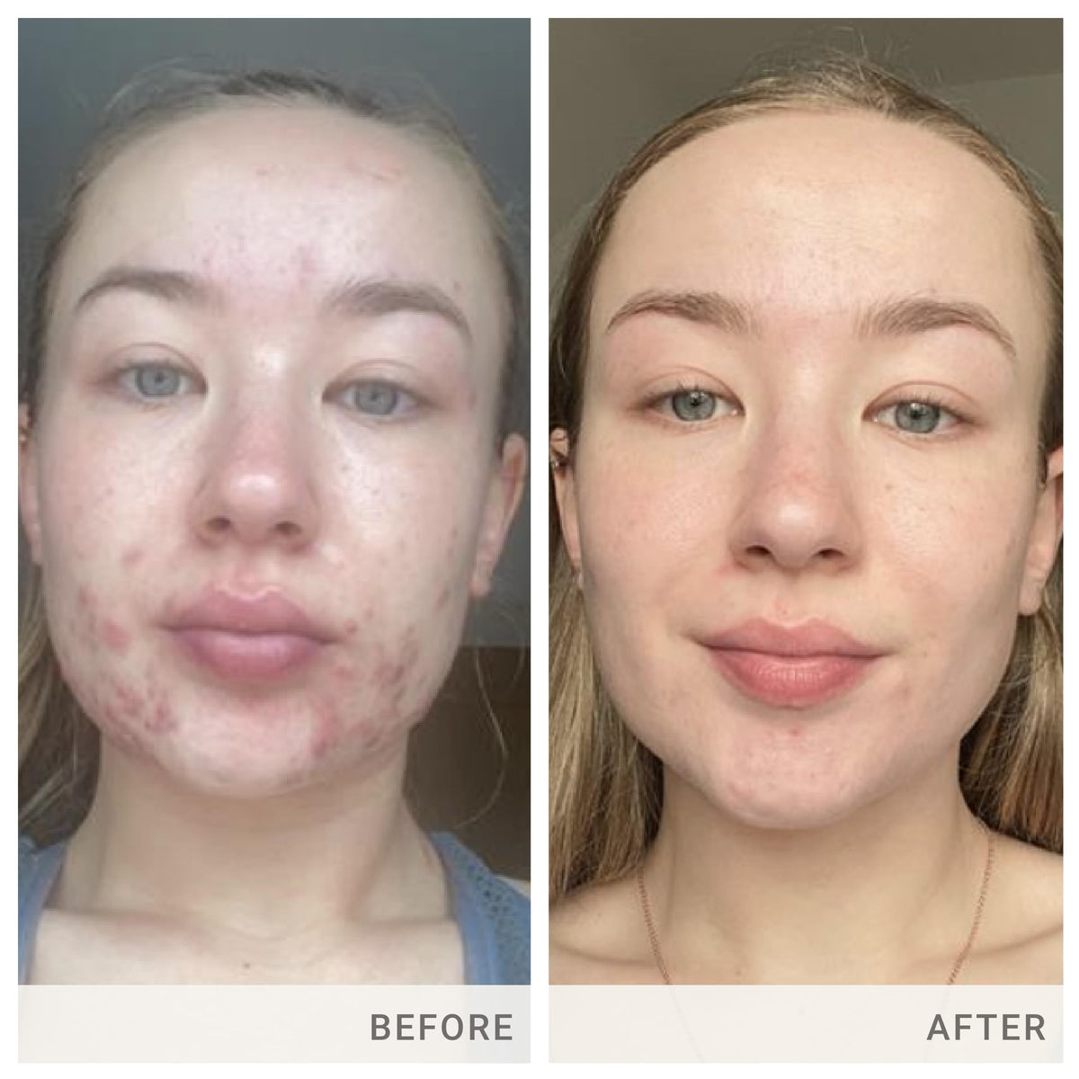jane iredale Skin Accumax Supplement - 30-Day Supply - image 4