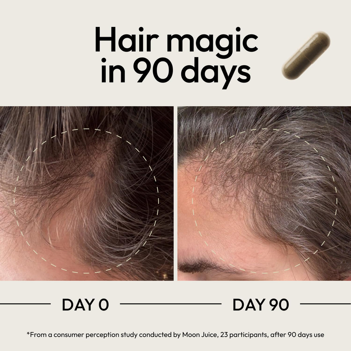 Moon Juice SuperHair Growth Vitamins Biotin & Saw Palmetto - 120 Capsules - image 4