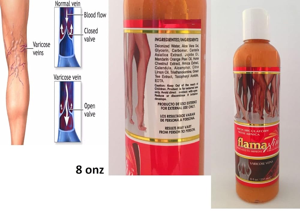 Generic Flamaxin Varicose Vein Cream - 8 Fl Oz - image 2