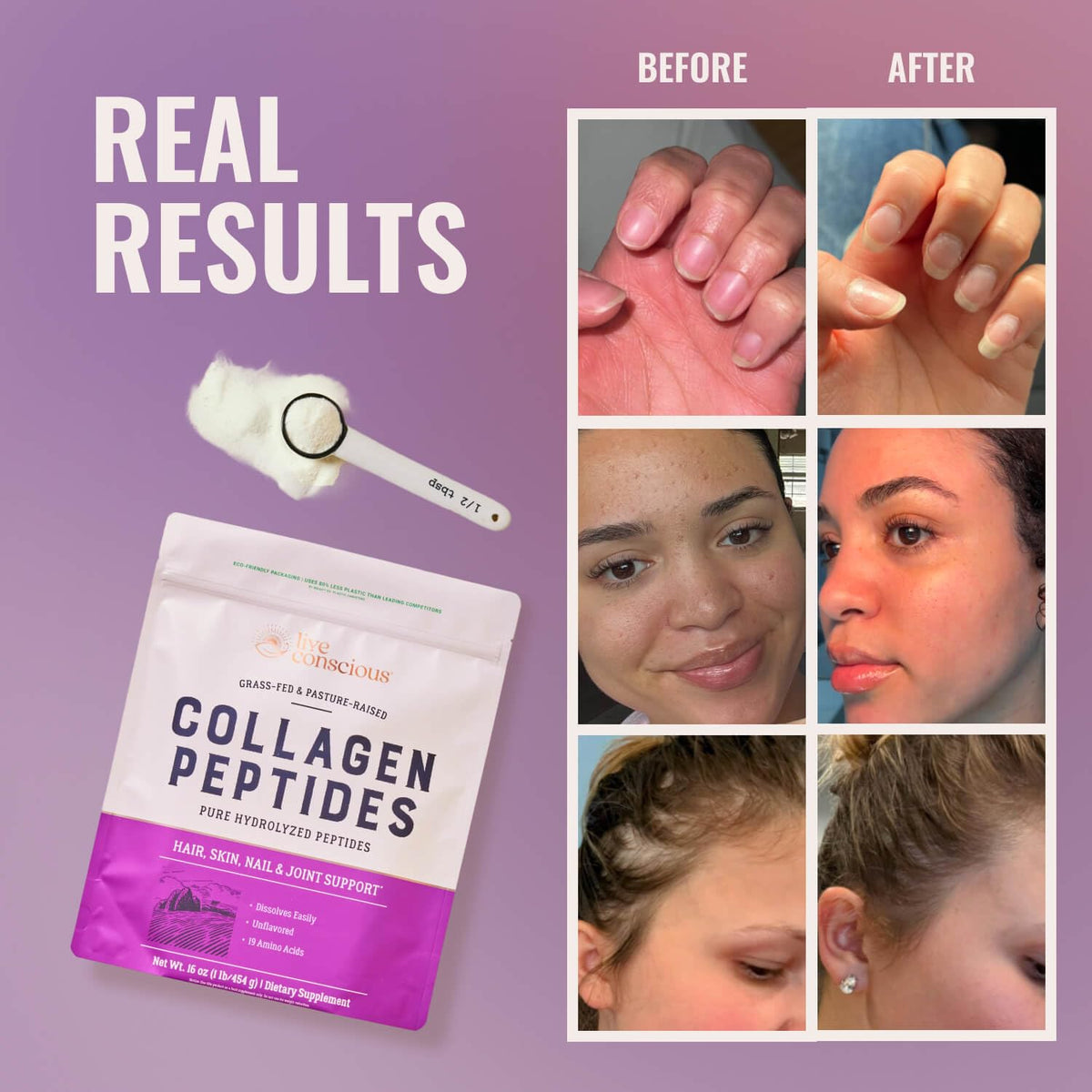 Live Conscious Collagen Peptides Powder - Hair, Skin & Joint Support - 16oz - image 2