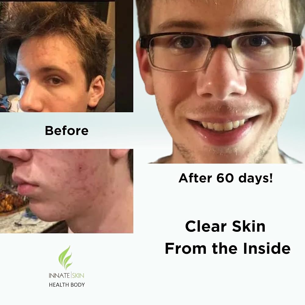 Innate Skin Clear Skin Vitamin System - image 5