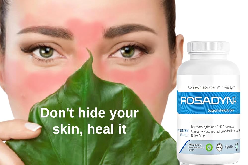 Rosadyn+ Rosacea Skin Care Supplement - 60 Capsules - image 5