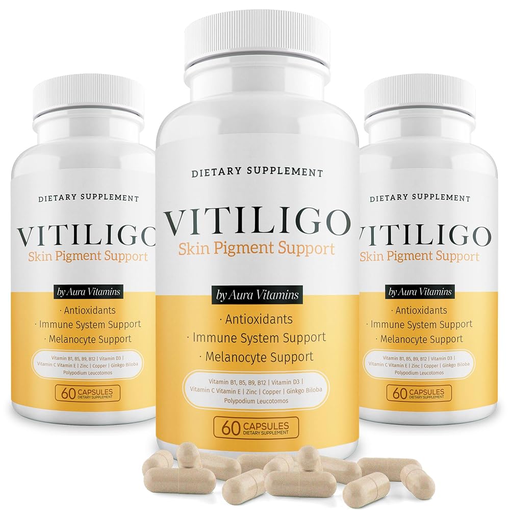 AURA VITAMINS Dermawonder Vitiligo Capsules 60 Count