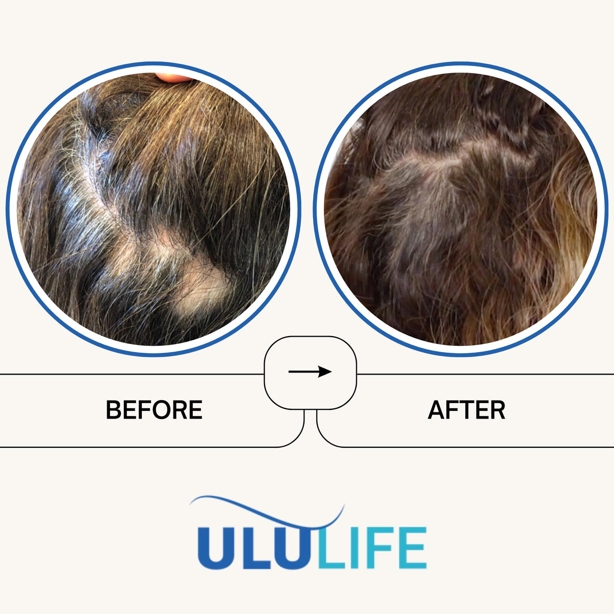 ULULIFE Ultimate Regrow Multivitamin for Hair, Skin & Nails - 540 Capsules - image 3