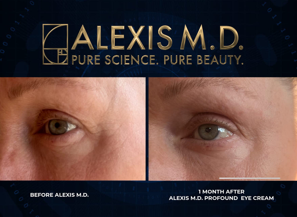 ALEXIS M.D. Profound C Complex Vitamin C Serum - 30ml - image 2