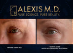 ALEXIS M.D. Profound C Complex Vitamin C Serum - 30ml - image 2