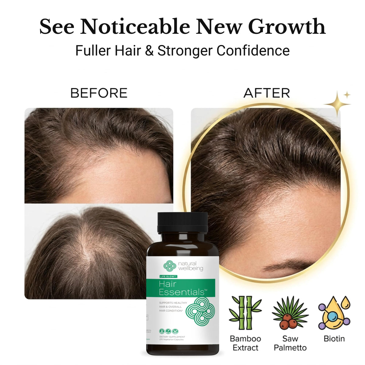 Natural Wellbeing Hair Essentials - Supports Healthy Hair with Saw